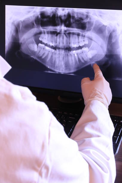 Best Emergency Dental Extractions in Cape Neddick, ME